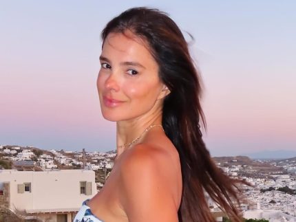 vera-viel-revela-sequela-apos-cancer-raro-na-coxa:-“circulacao-ficou-prejudicada”