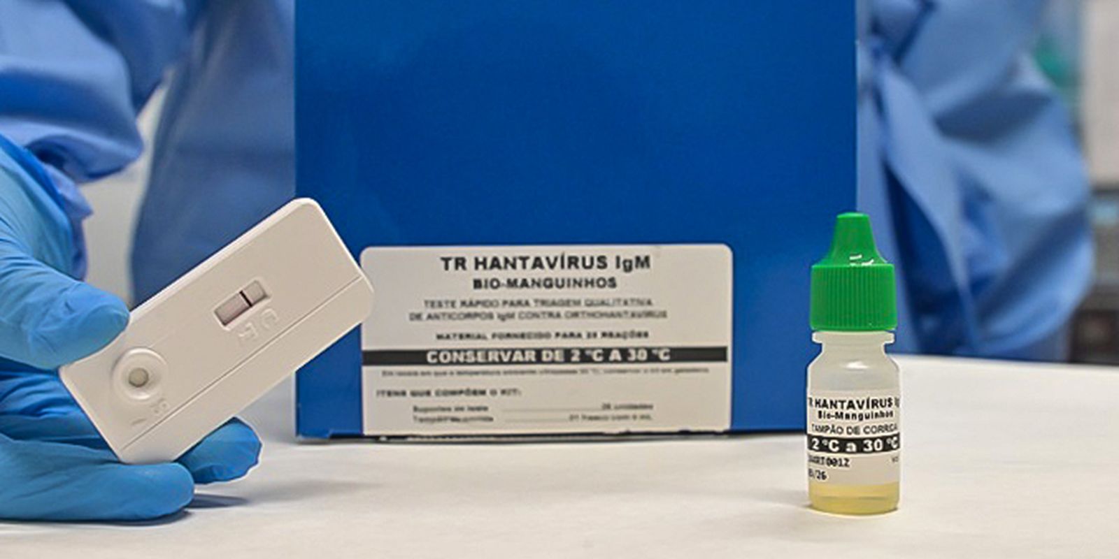 novo-teste-faz-diagnostico-de-hantavirose-em-20-minutos