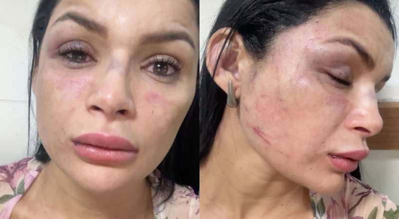 musa-de-escola-de-samba-e-espancada-durante-corrida-de-aplicativo;-veja-video