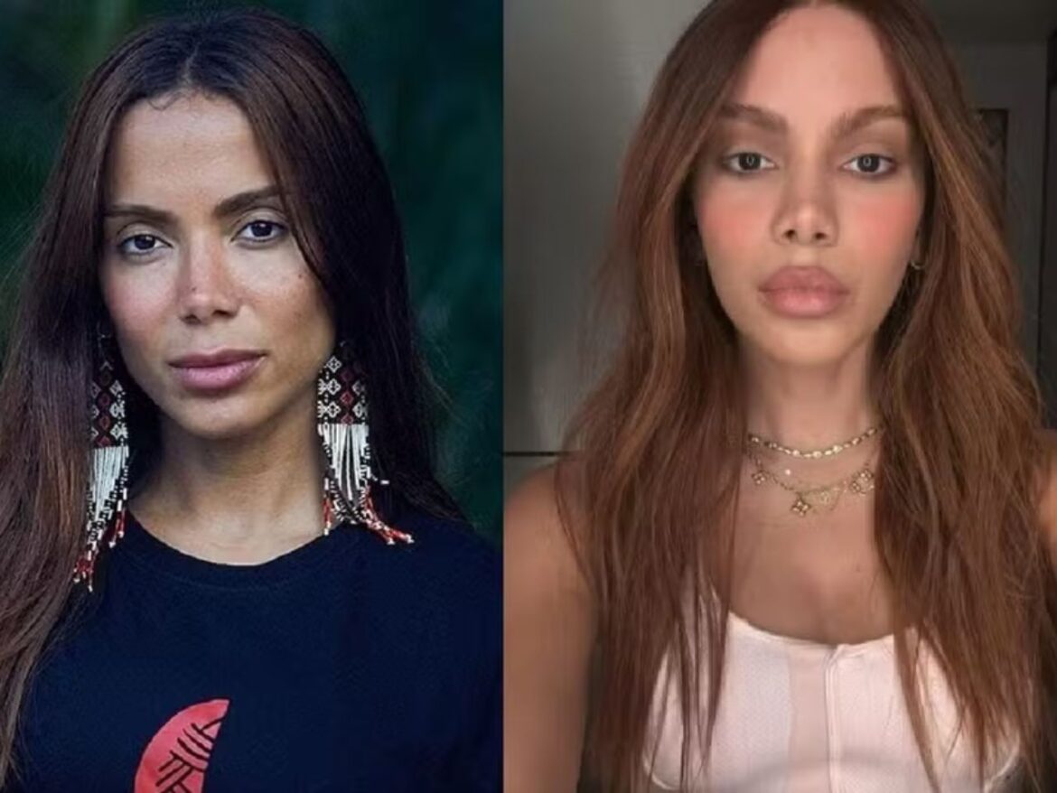 anitta-revela-o-que-a-motivou-a-fazer-plasticas;-veja