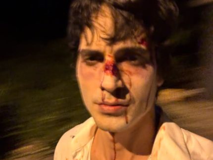 fiuk-assusta-fas-ao-surgir-com-o-rosto-machucado-em-foto-publicada-nas-redes