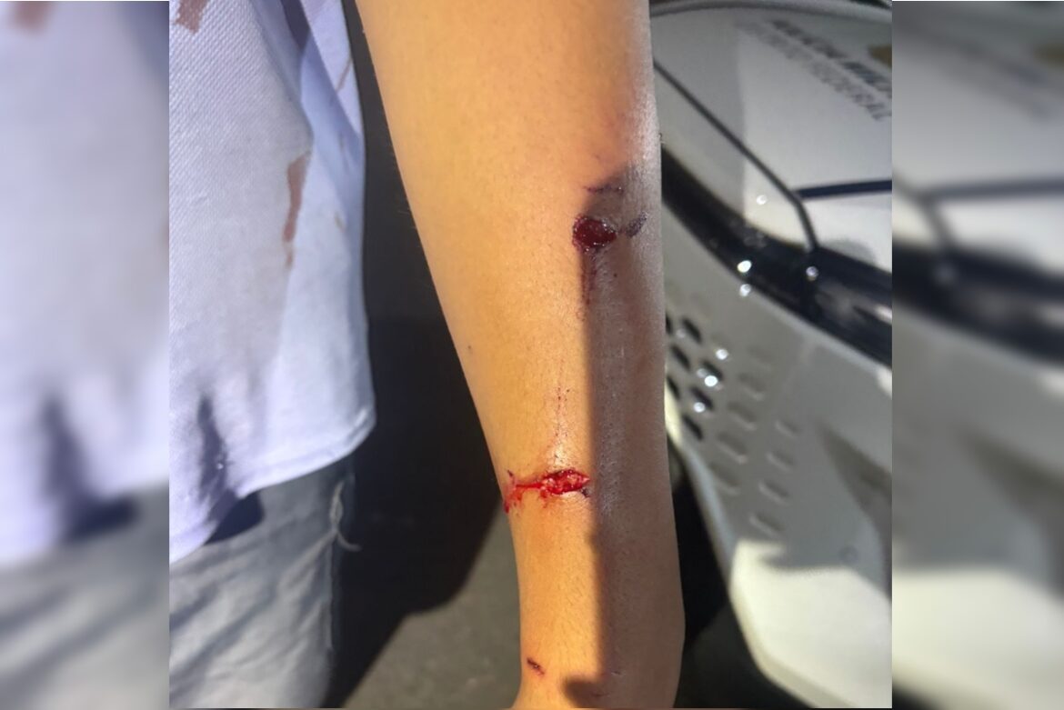 veja-como-ficaram-crianca-e-policial-atacados-por-pit-bulls-no-df