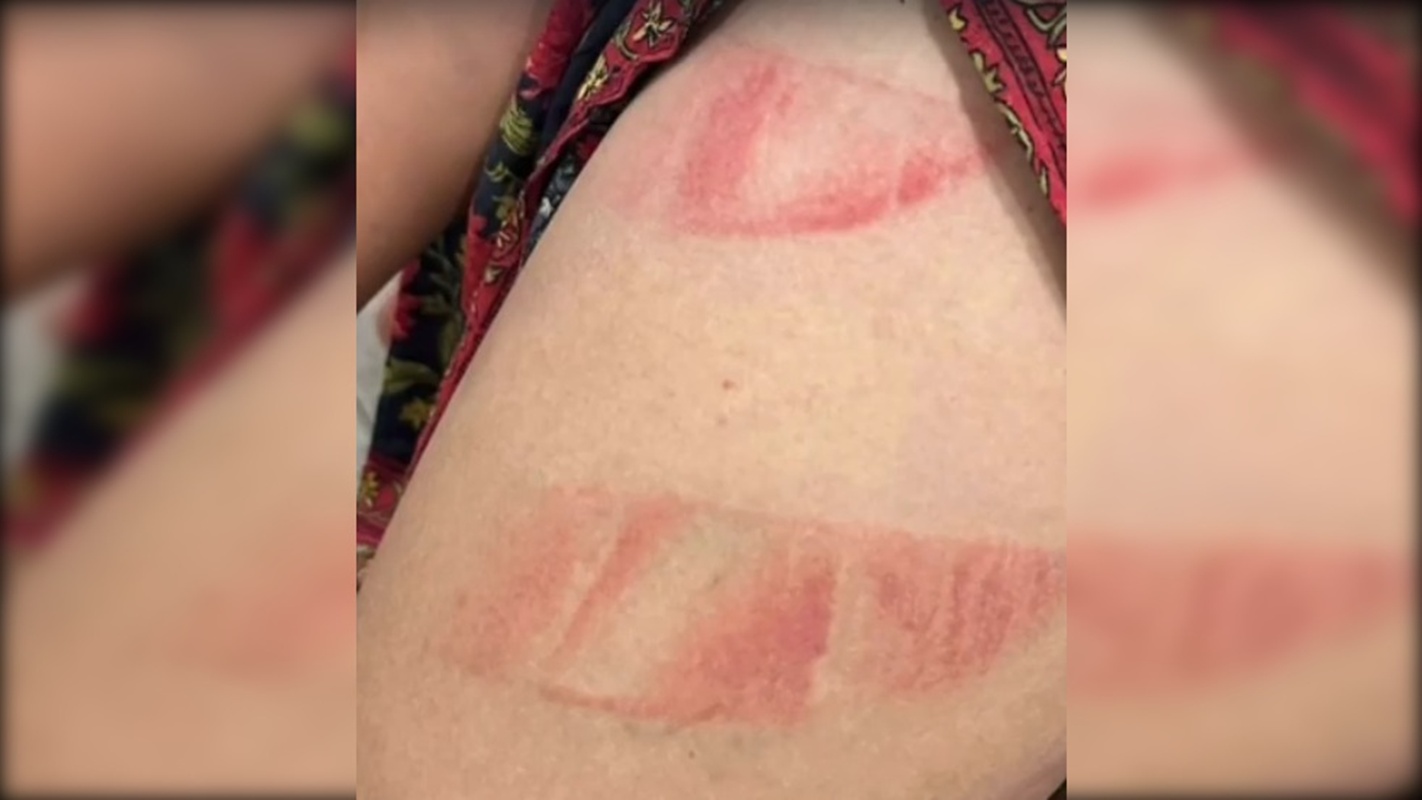 marido-e-preso-apos-ameacar-degolar-mulher-e-esfolar-rosto-de-bebe