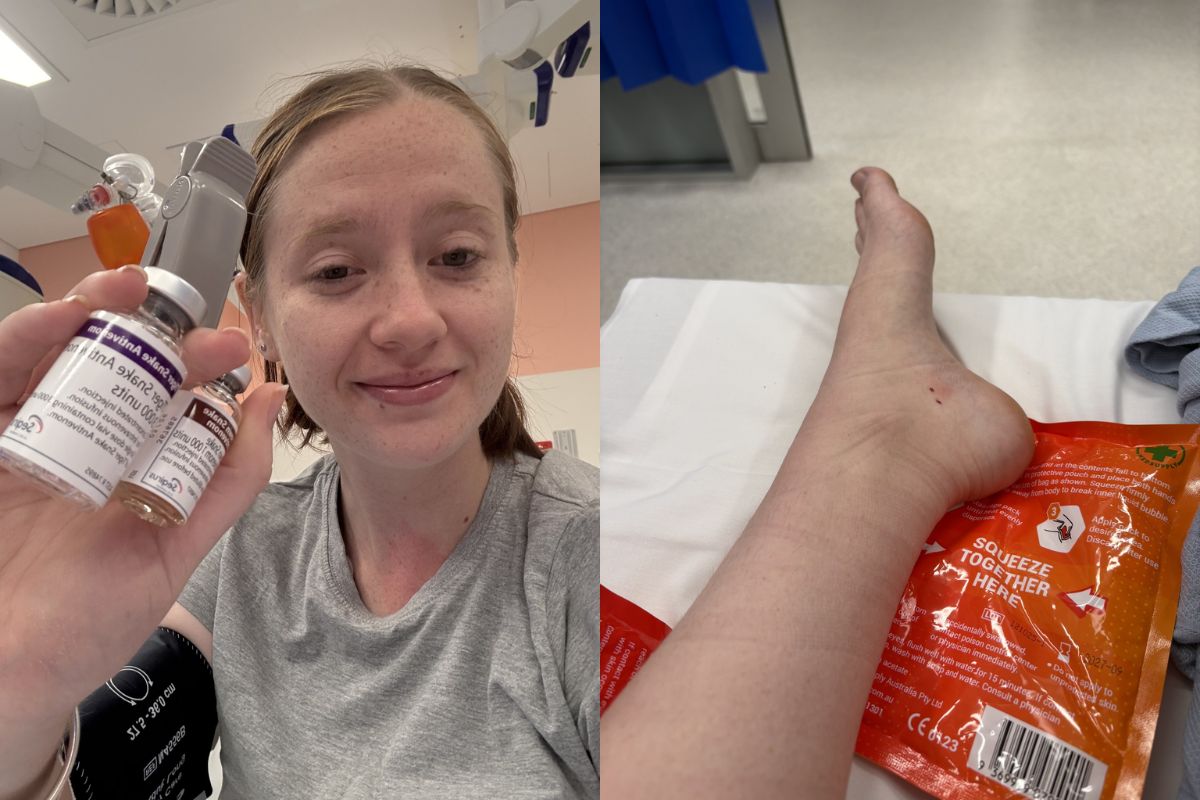 mulher-e-picada-por-uma-das-serpentes-mais-venenosas-do-mundo