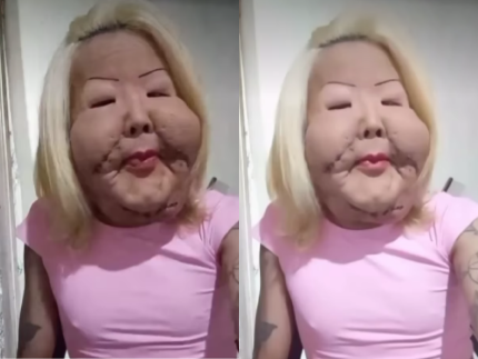 juju-do-pix-relata-complicacao-apos-cirurgia-para-retirar-oleo-mineral-do-rosto