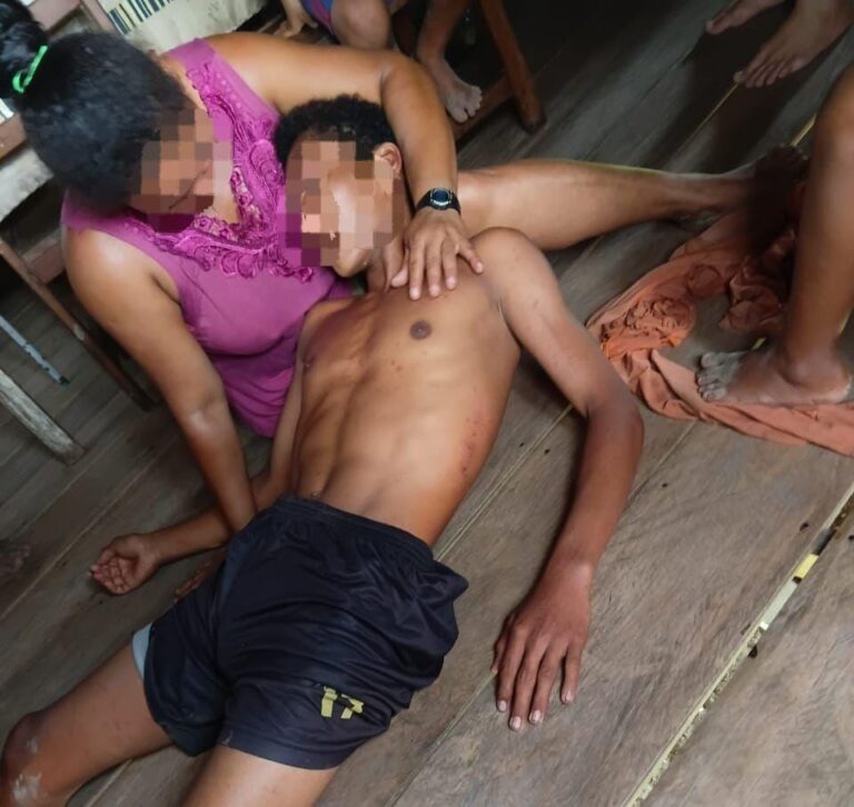 Adolescente sobrevive 5 dias perdido na floresta e sai guiado por fogos de artifício no Acre