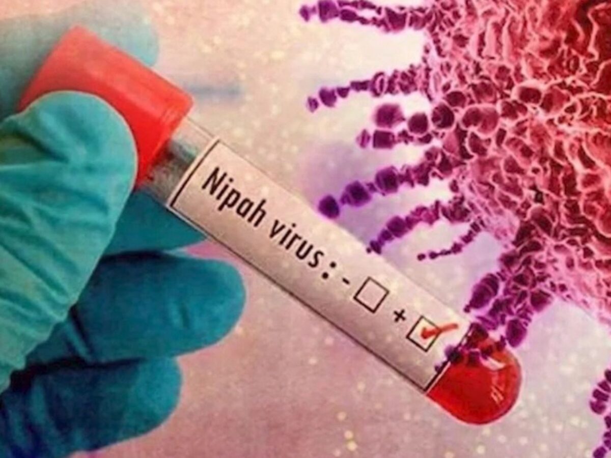 virus-nipah:-japao-inicia-testes-clinicos-para-vacina
