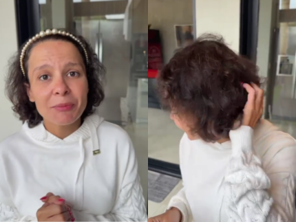 alopecia-androgenetica:-especialista-explica-condicao-que-fez-maiara-perder-quase-todo-o-cabelo