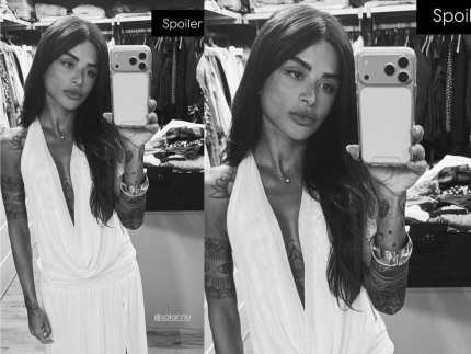 ex-bbb-aline-campos-revela-que-foi-liberada-para-carnaval-apos-cirurgia:-“nao-estarei-100%”