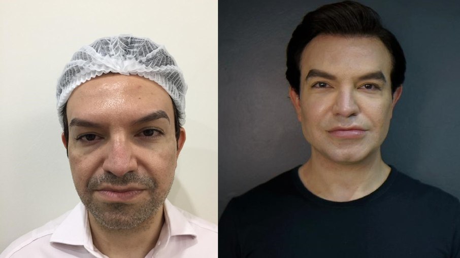 Ken Humano faz harmonização ‘na porta dos fundos’ e diz não se arrepender
