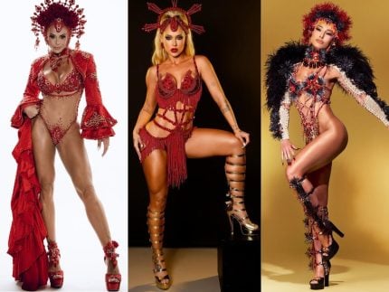 os-procedimentos-esteticos-que-viraram-tendencia-entre-musas-e-rainhas-no-carnaval-2026