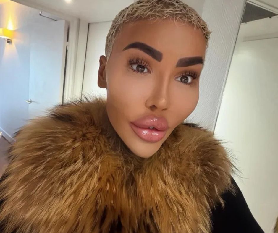 morre-o-influenciador-conhecido-como-‘rei-dos-labios’