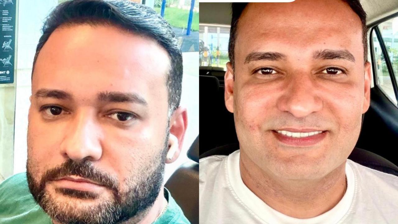 Secretário fez um post nas redes sociais sobre o novo visual