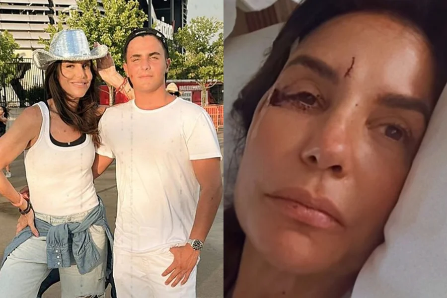 Cantora Ivete Sangalo tranquiliza fãs após acidente doméstico em Salvador.