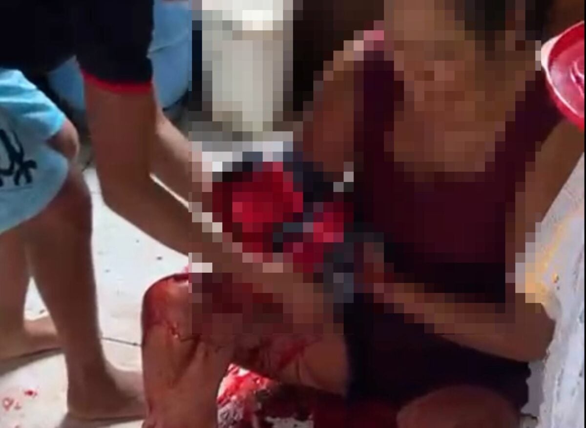 Mulher resiste após ser atingida com 16 golpes de faca no interior do Acre