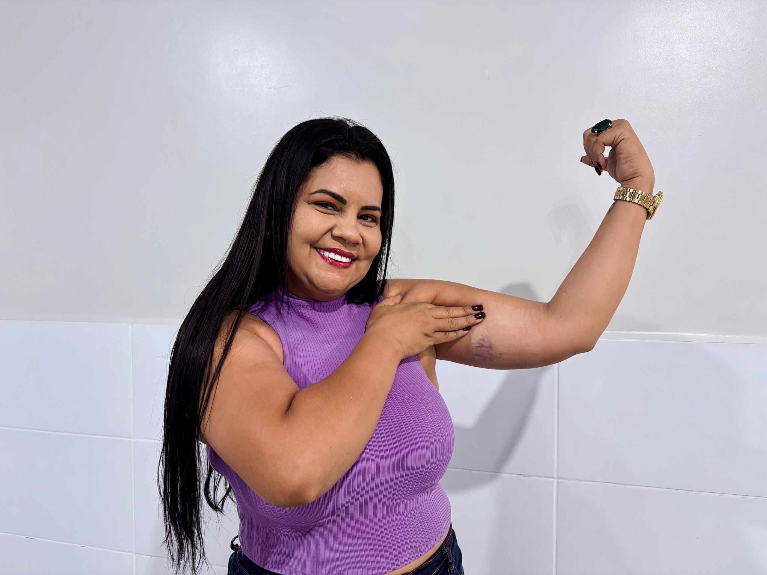 Rio Branco amplia acesso ao Implanon e já beneficia mais de 1.300 Mulheres