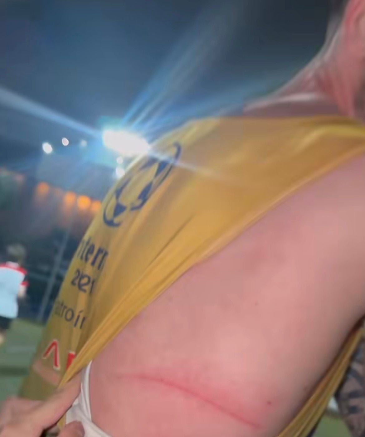 Vídeo bem-humorado de jovem explicando arranhão após futebol com amigos da igreja diverte e viraliza nas redes sociais.