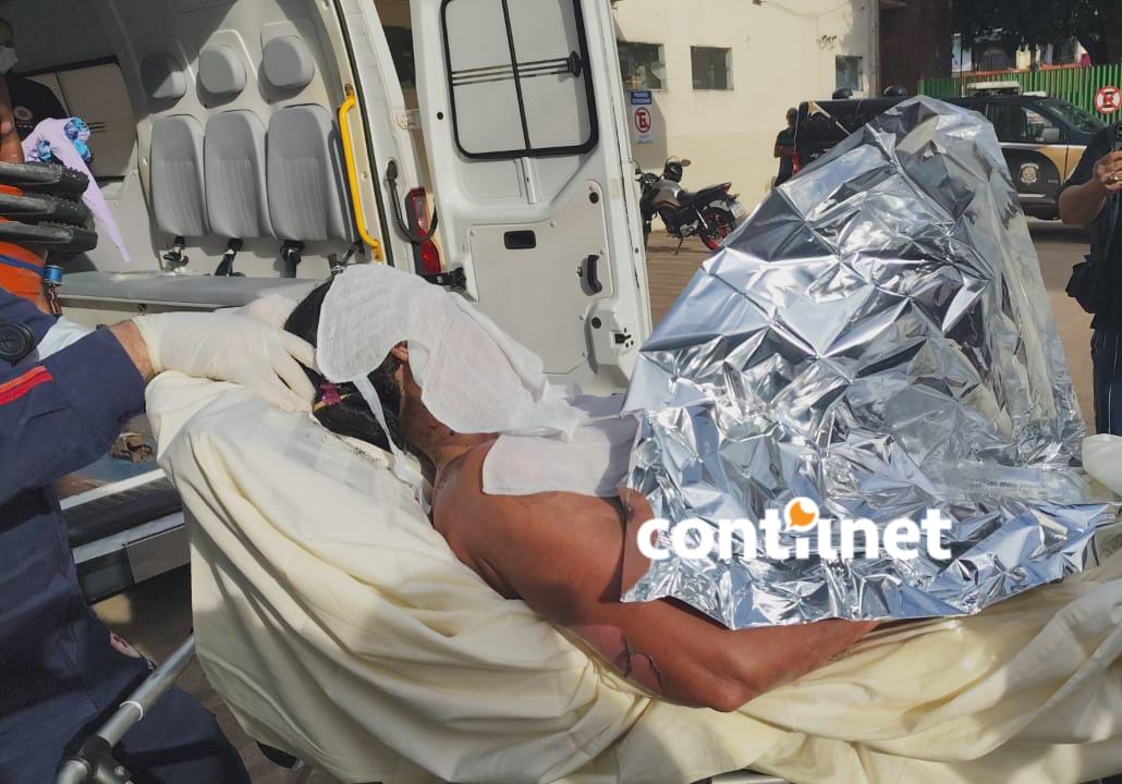 Oito pessoas sofreram queimaduras de segundo e terceiro graus após explosão em residência no bairro Tropical, em Rio Branco.