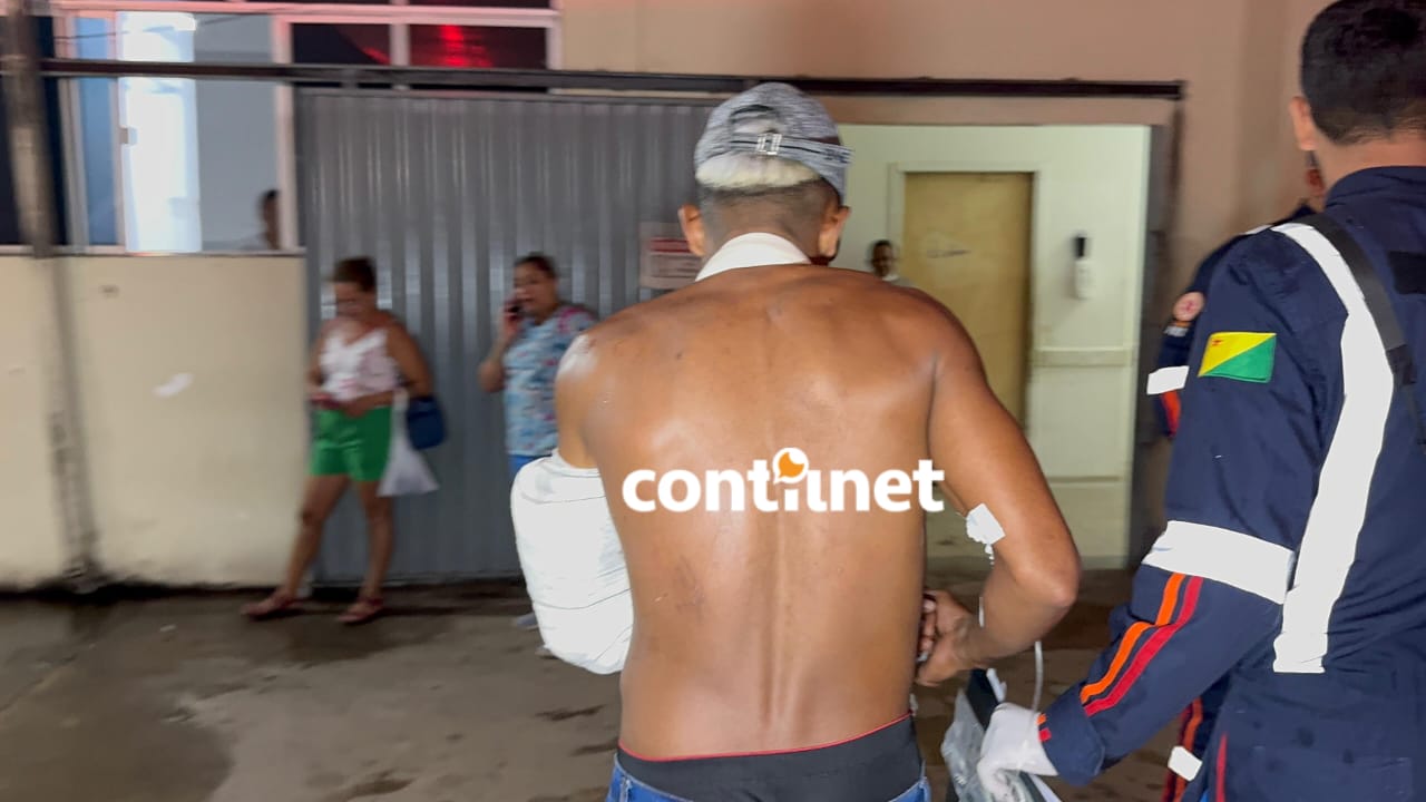 Homem de 34 anos foi baleado ao voltar para casa, teve fratura no braço e foi transferido ao Pronto-Socorro; caso será investigado pela Polícia Civil.