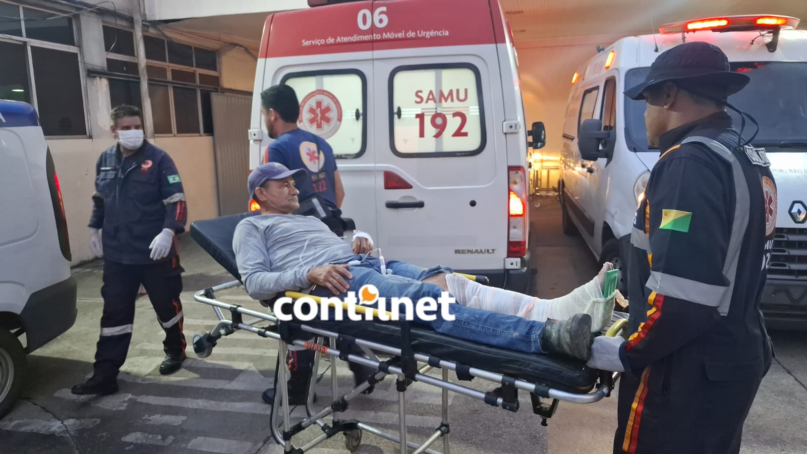 Freada brusca derruba motociclista e provoca fratura na perna em Rio Branco