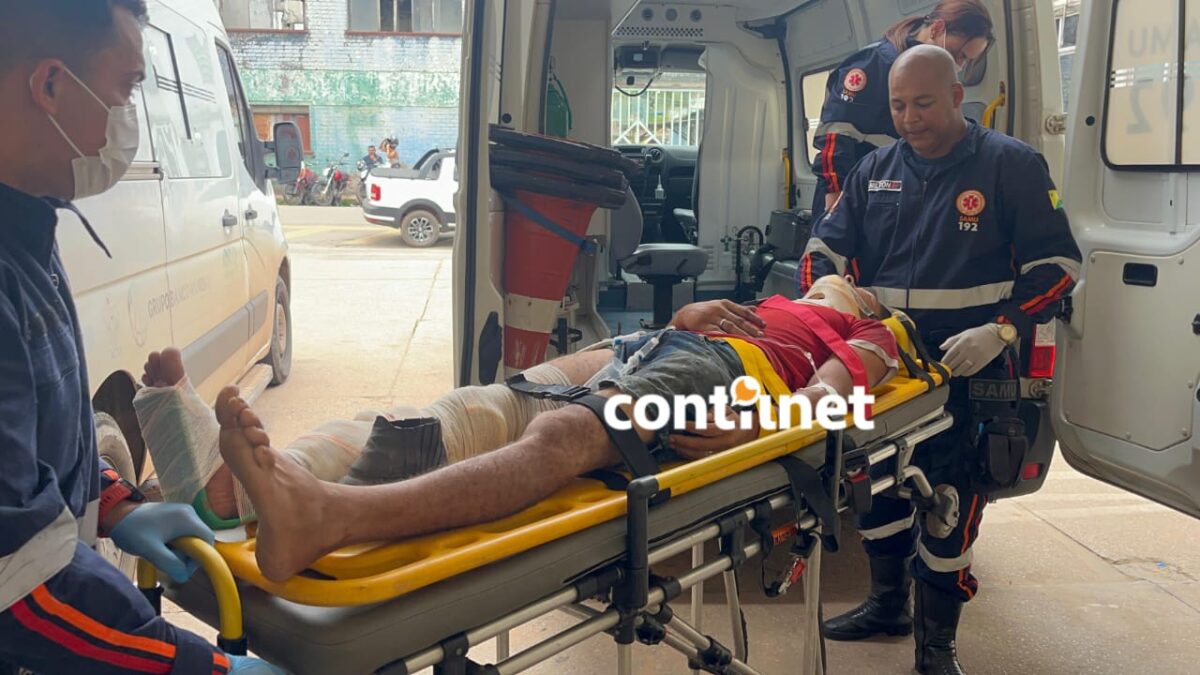 Jovem tem fratura exposta após atingir caçamba em avenida movimentada de Rio Branco