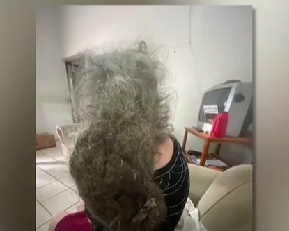 Idosa é encontrada em situação de abandono e com ninho de rato no cabelo