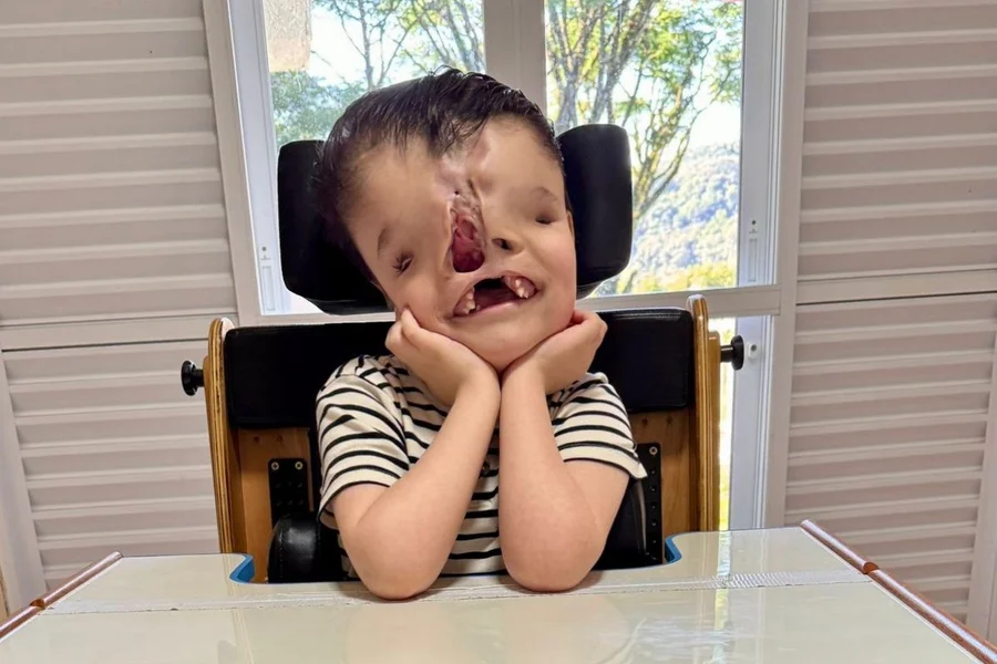 Campanha de arrecadação para a cirurgia do menino Joaquim Lorenzo.