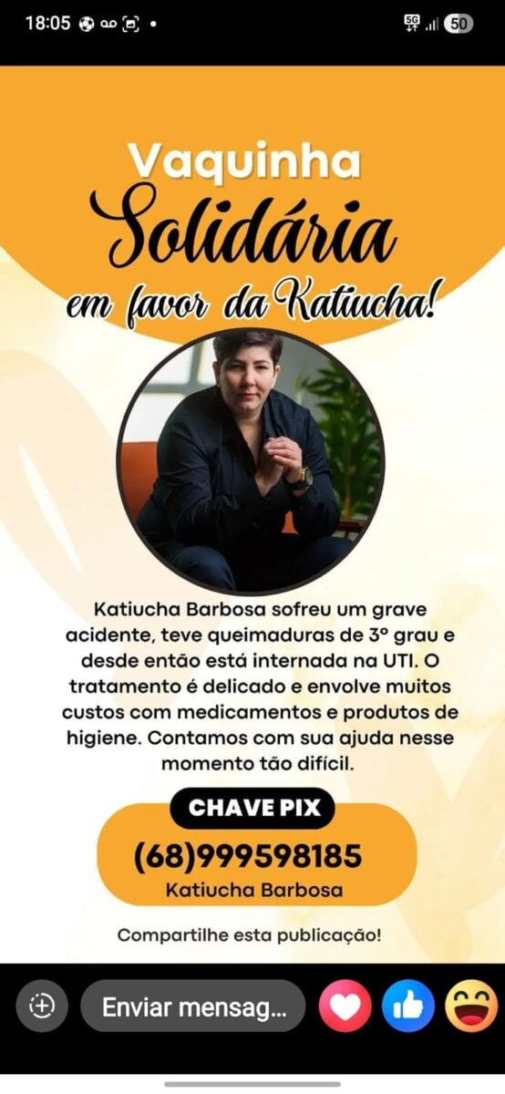 Katiucha Barbosa está internada na UTI após sofrer queimaduras de 3º grau e necessita de apoio para custear o tratamento.