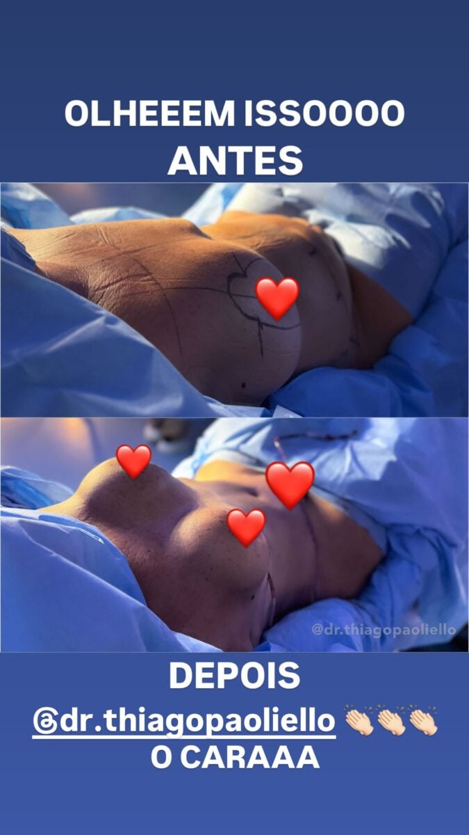 virginia-choca-fas-ao-revelar-resultados-das-cirurgias-plasticas-de-mae;-veja-resultado