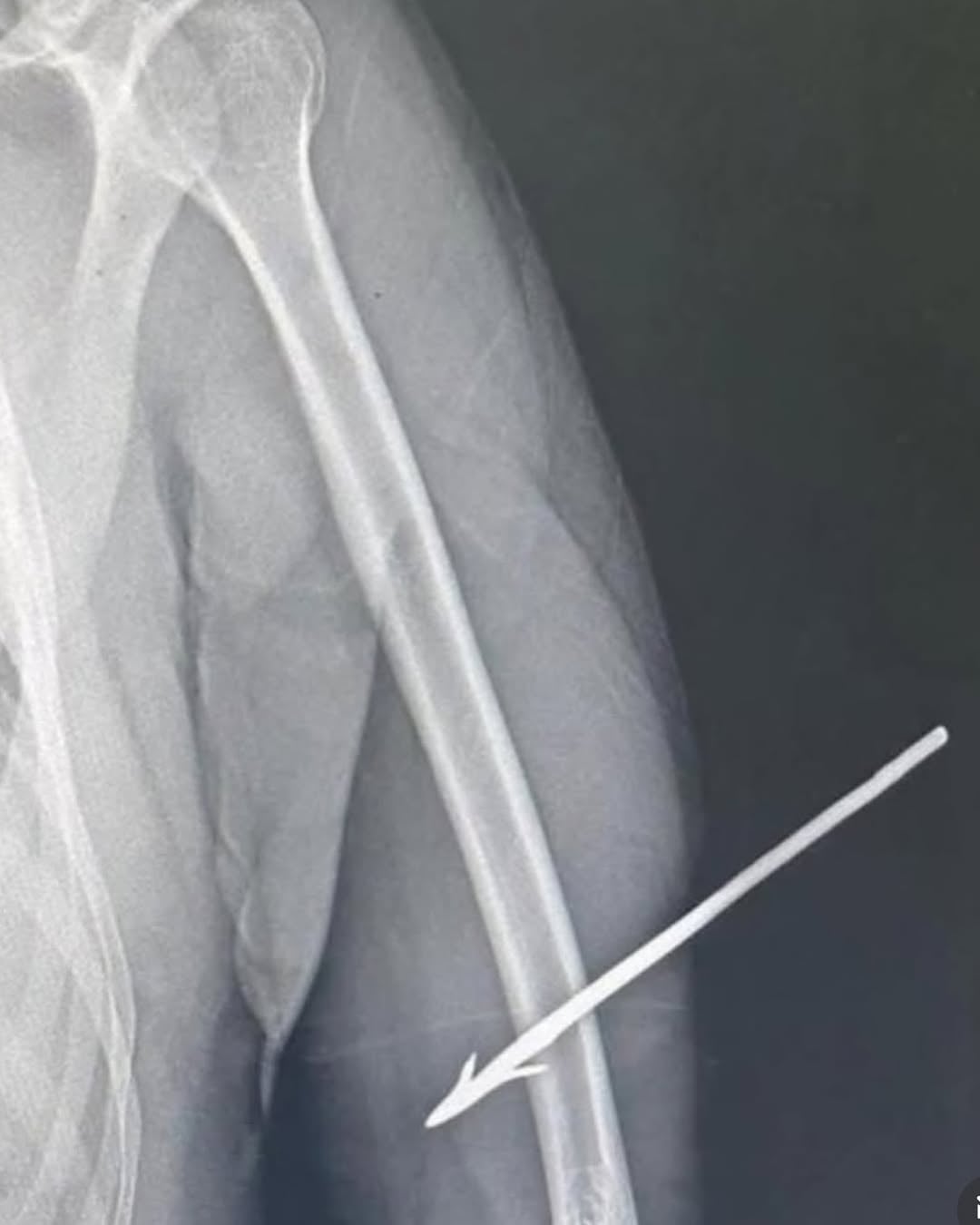 Policial federal é atingido por flecha em operação contra garimpo ilegal