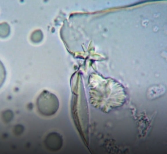 Cientistas identificam molécula que pode enfraquecer células cancerígenas