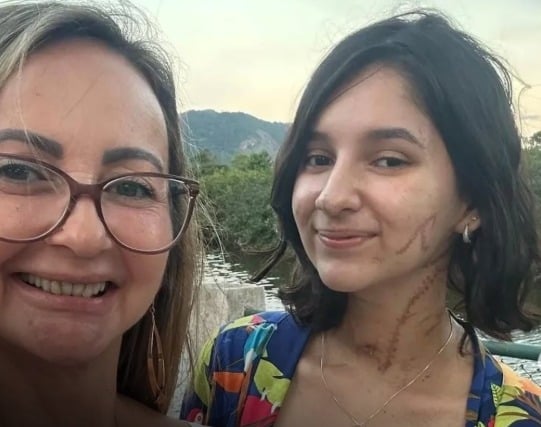 Após sobreviver a ataque, jovem faz primeiro passeio