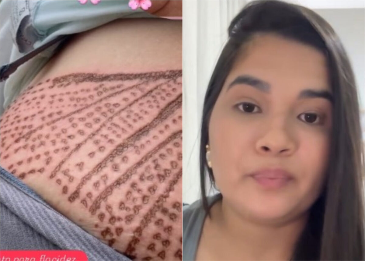 Mulher em desabafo sobre danos estéticos, com expressão de preocupação.