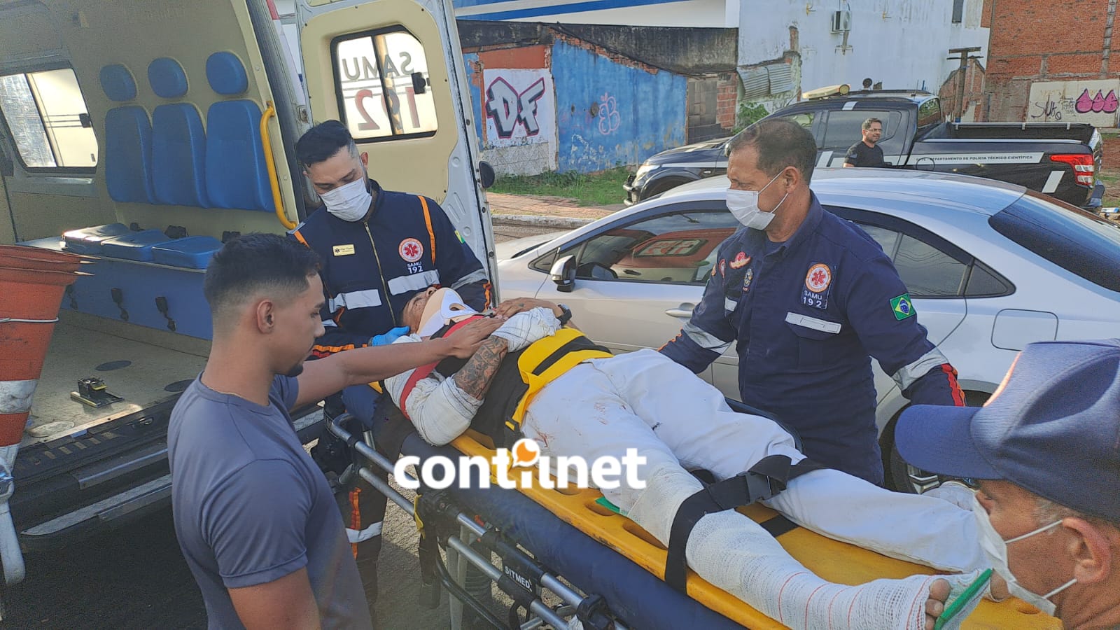 Colisão Em Rio Branco Deixa Dois Homens Com Fraturas Expostas (6)