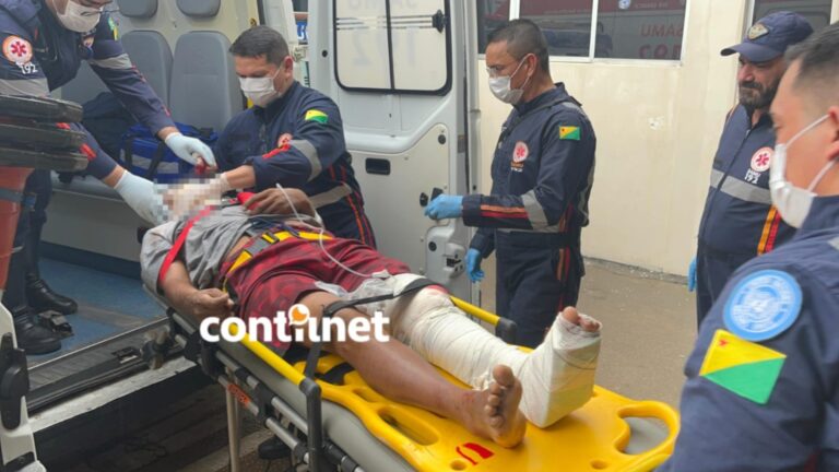 Colisão Entre Motos Deixa Dois Feridos Na Baixada Da Sobral