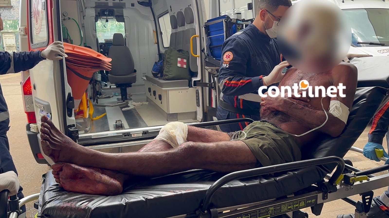 Homem é Ferido A Golpes De Terçado No Interior Do Acre; Saiba Mais (4)