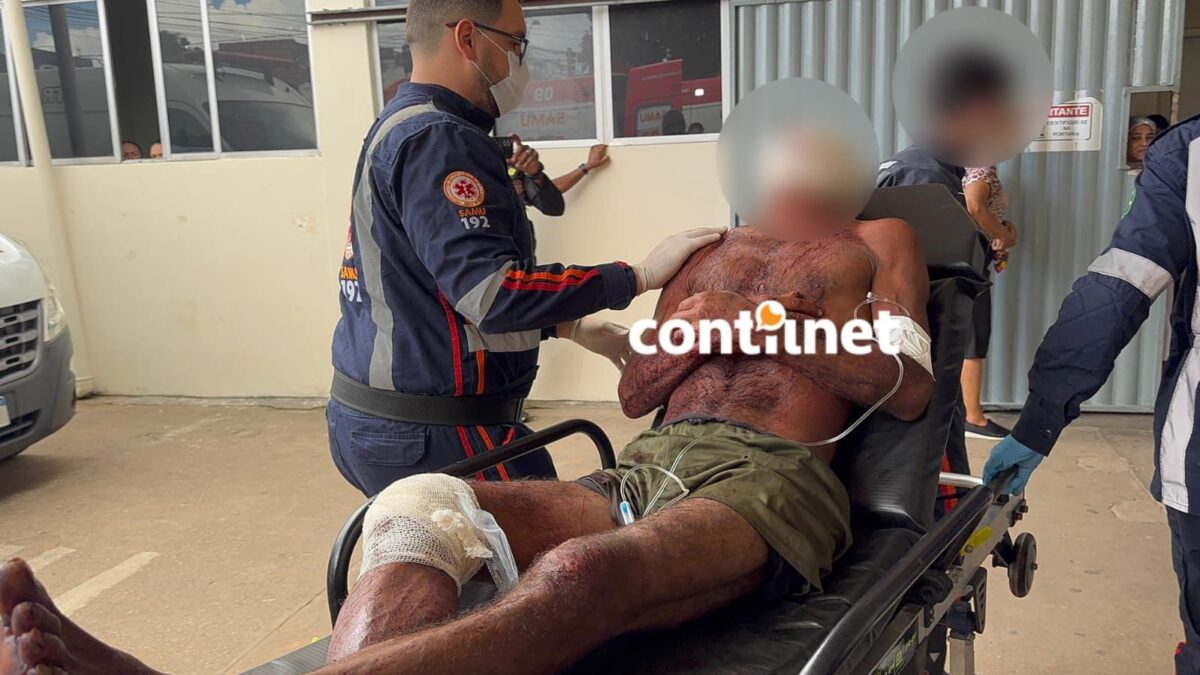 Homem é Ferido A Golpes De Terçado No Interior Do Acre; Saiba Mais (5)