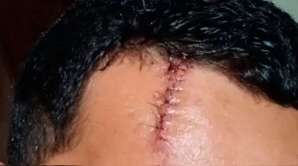 Funcionário é atacado com pá por colega em supermercado no Acre