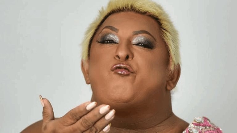 Influenciadora Patixa Teló sofre atropelamento de patinete; saiba mais