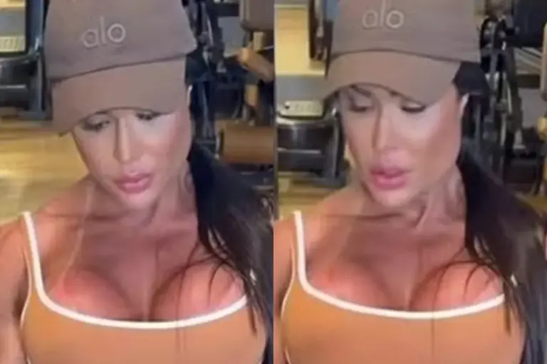 Gracyanne Barbosa mostrou que nem mesmo ela está imune às inseguranças estéticas e dores físicas. Nesta quarta-feira (08/04), a influenciadora emocionou a web ao relatar como tem sido o "reaprendizado" do seu corpo seis meses após operar o tendão quadricipital.