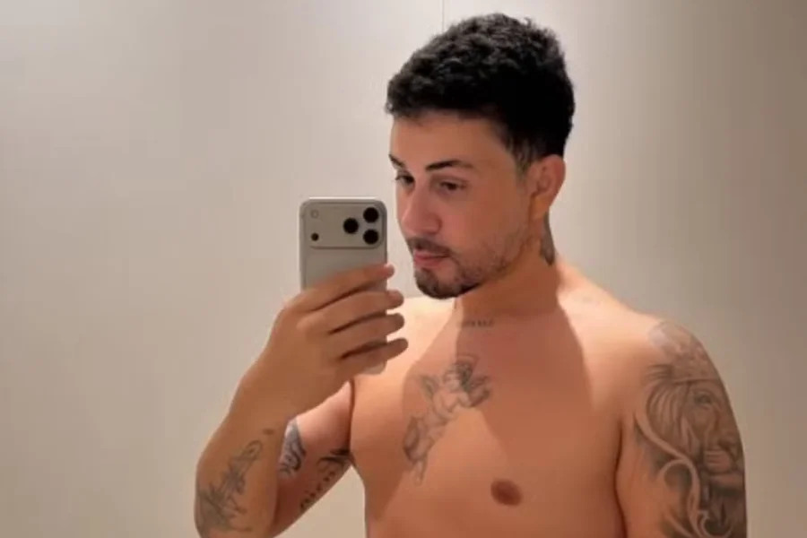 Carlinhos Maia mostra rosto após realizar nova cirurgia no rosto