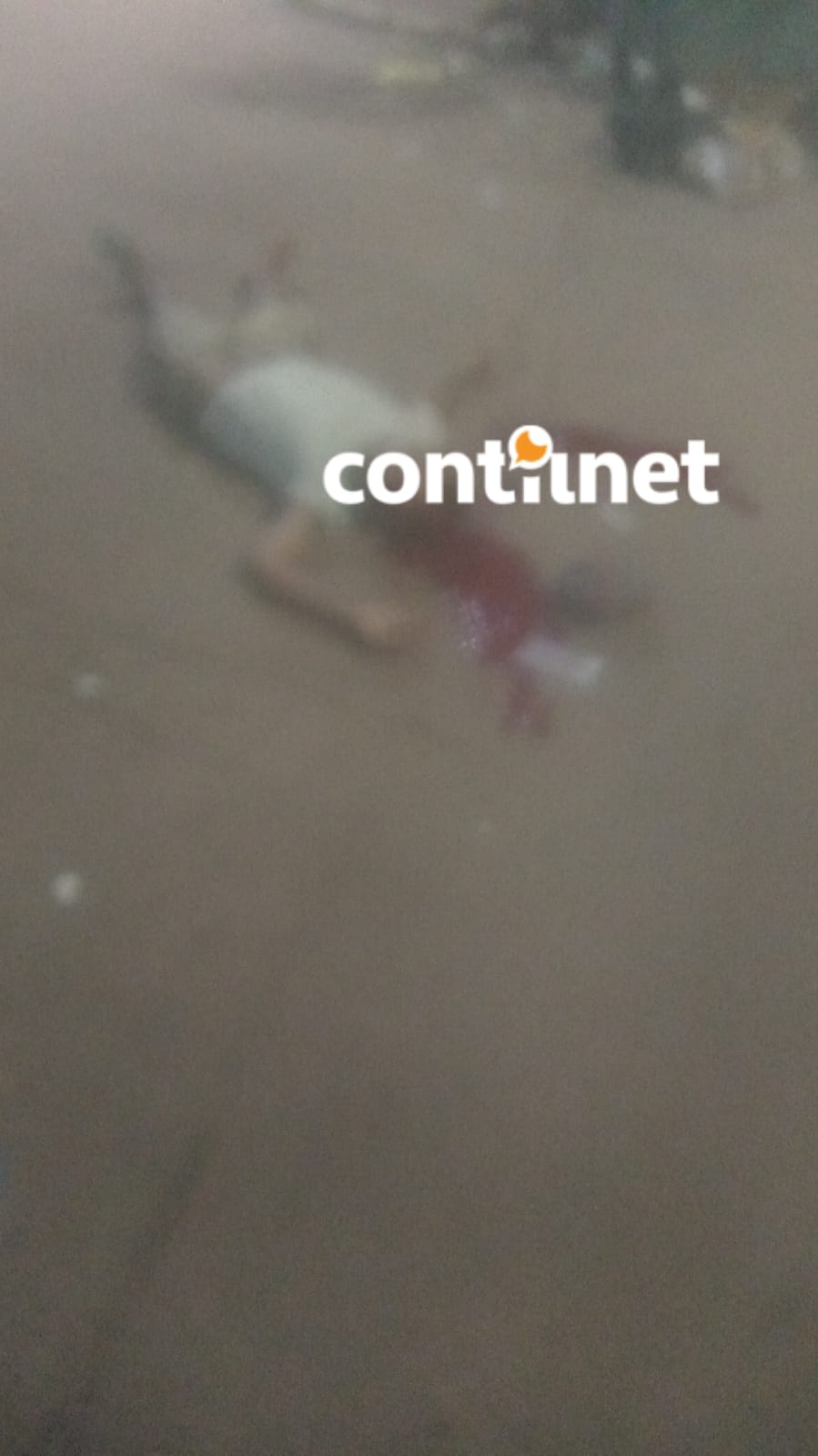 Morador de rua é baleado na cabeça e levado em estado grave ao PS da capital