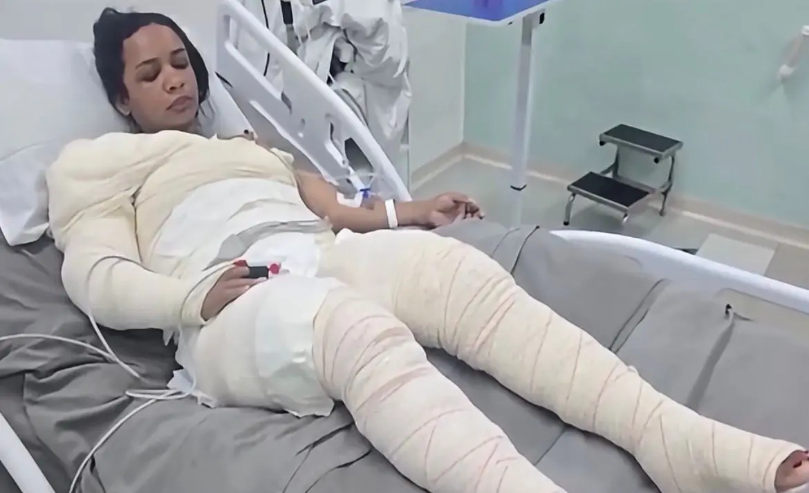 Mulher denunciou o ex por ataque com fogo antes de morrer em hospital