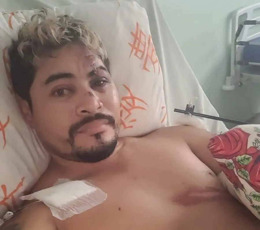 Família mobiliza campanha após jovem ser atropelado em Brasiléia