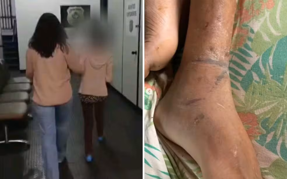 Mãe suspeita de manter filho acorrentado cometeu tortura brutal Mãe suspeita de manter filho acorrentado cometeu tortura brutal