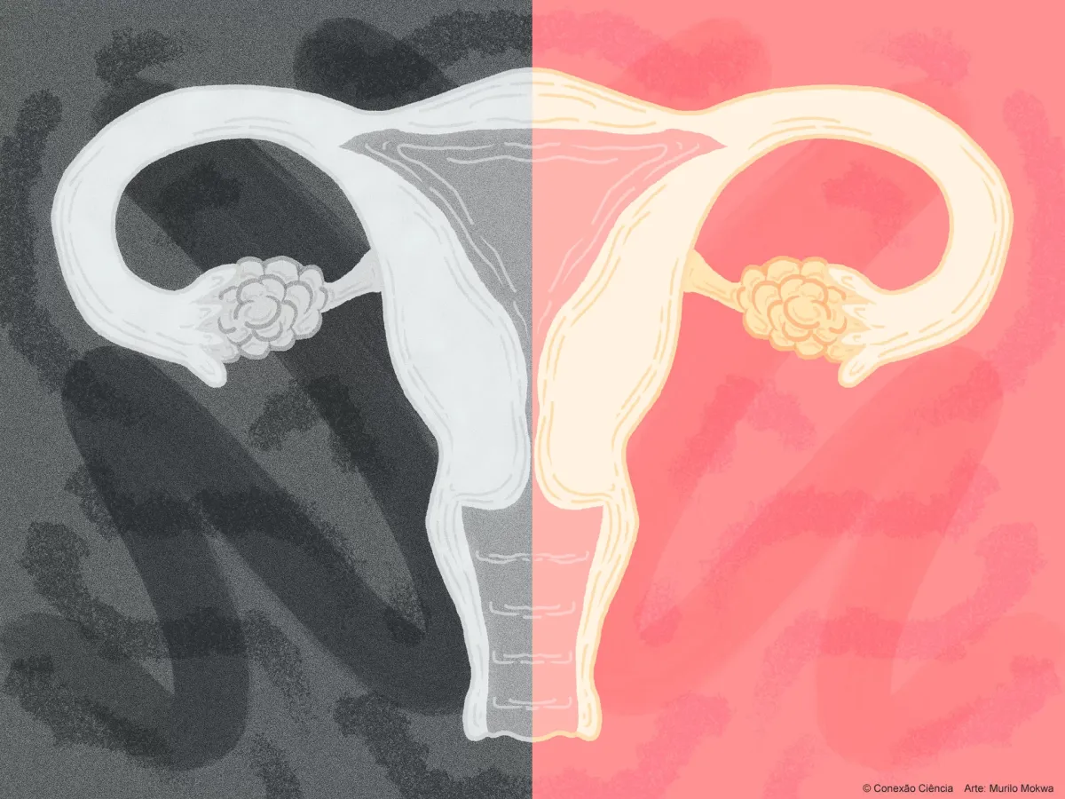 Pobreza menstrual faz uma em cada cinco alunas faltar à escola no Acre Pobreza menstrual faz uma em cada cinco alunas faltar à escola no Acre
