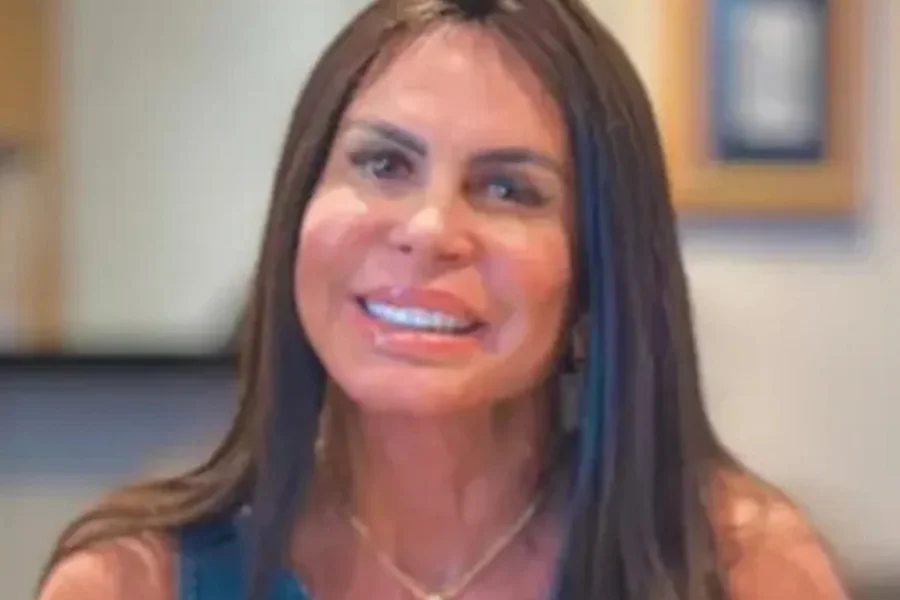 Gretchen aparece sem prótese: “Foi corte químico”