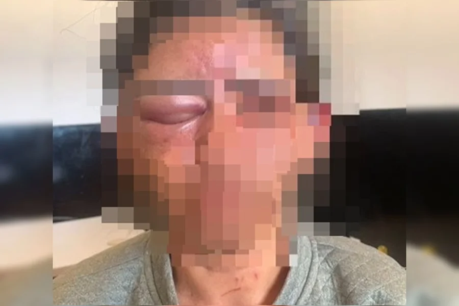 Homem invade casa, estrangula mulher com toalha e Ă© preso Homem invade casa, estrangula mulher com toalha e Ă© preso