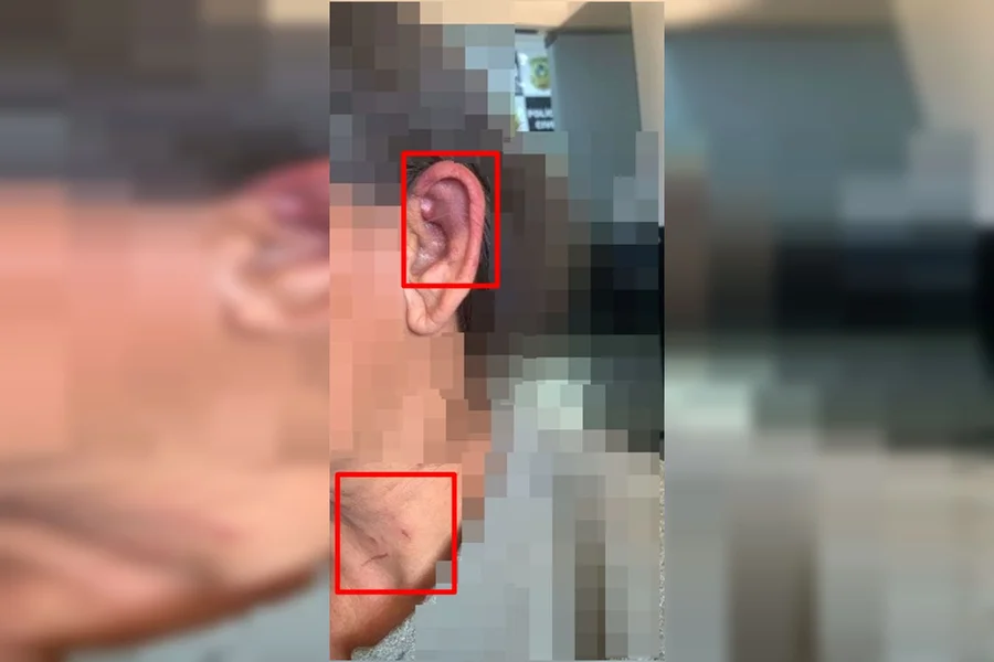 Mulher estrangulada com toalha foi atacada por amigo do filho Mulher estrangulada com toalha foi atacada por amigo do filho