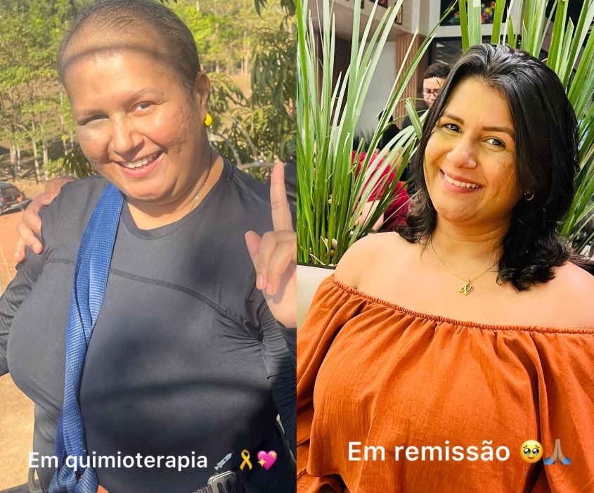 “Tenho sede de viver”: professora relata medo que não acaba após tratamento oncológico “Tenho sede de viver”: professora relata medo que não acaba após tratamento oncológico